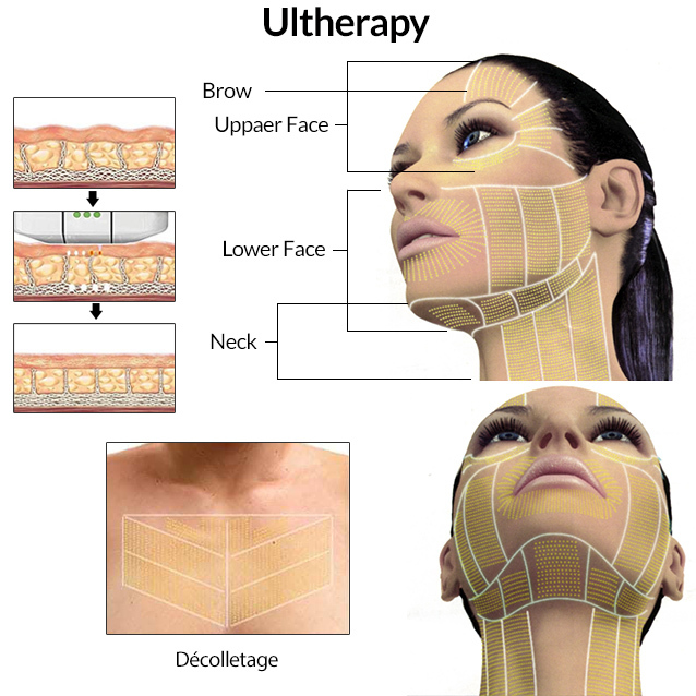 How to Effectively Lose Neck Fat in 2025: Proven Methods for a Slimmer You